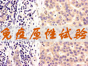 美迪西免疫原性試驗(yàn)服務(wù)