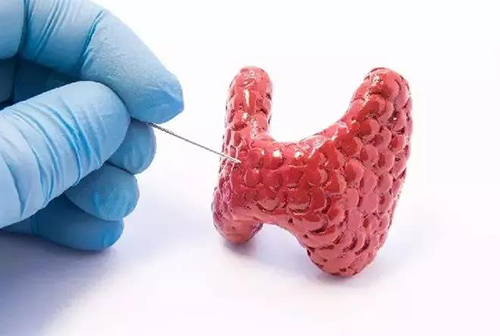 甲狀腺疾病，包括甲狀腺功能減退和甲狀腺功能亢進，自古以來就是反復被醫(yī)學研究人員研究的疾病